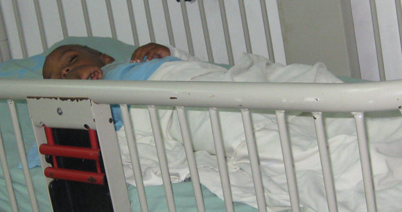 Toddler in the Burn Care Unit